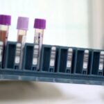 Bahia é contemplada com pontos de coleta para exame genético de doenças raras no SUS