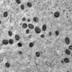 Mpox não é motivo de alerta, diz Ministério da Saúde após 140 casos no Brasil em 2026